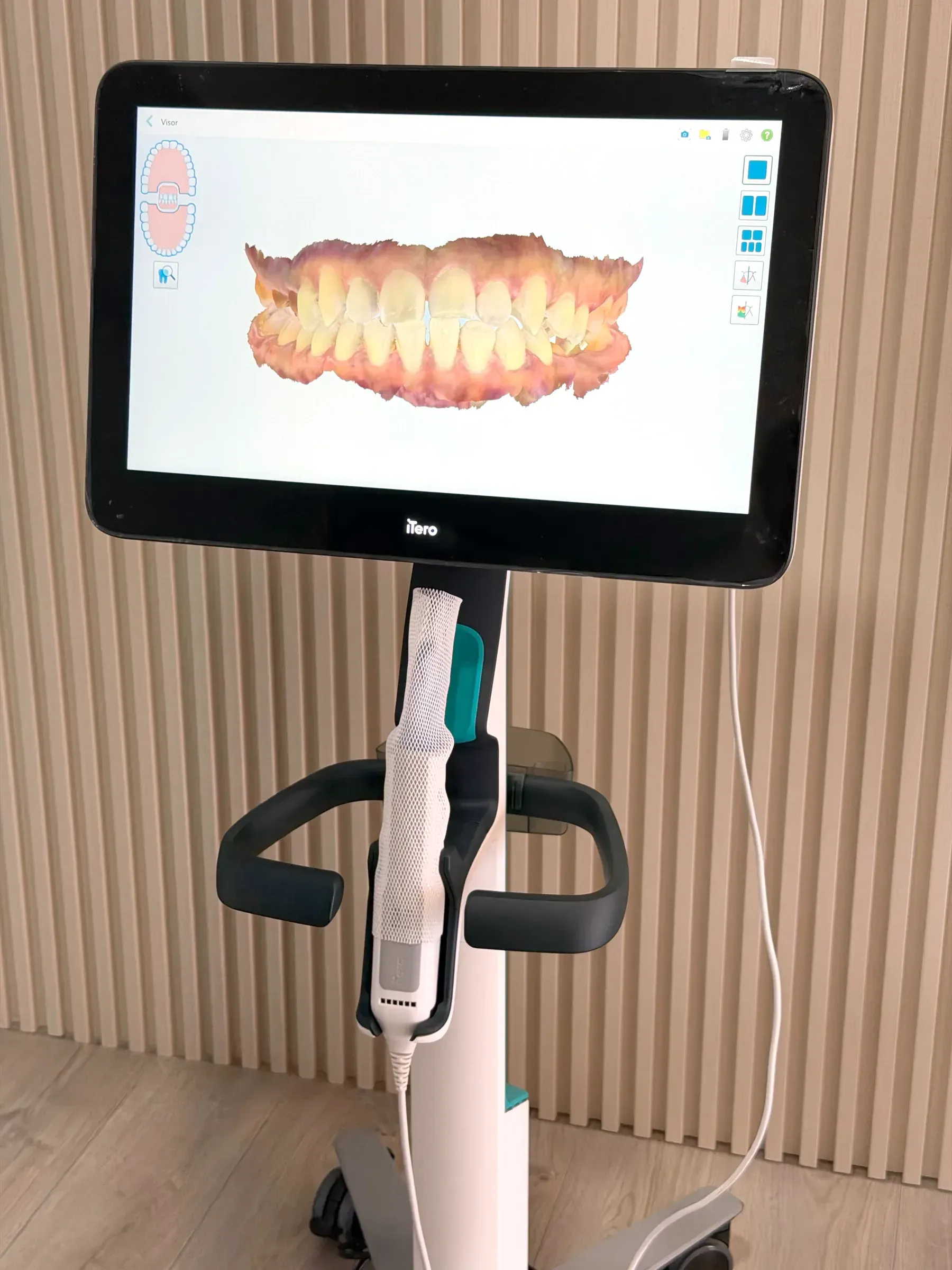 Escáner intraoral con el modelo 3D de una arcada en la pantalla, frente a un muro de listones.